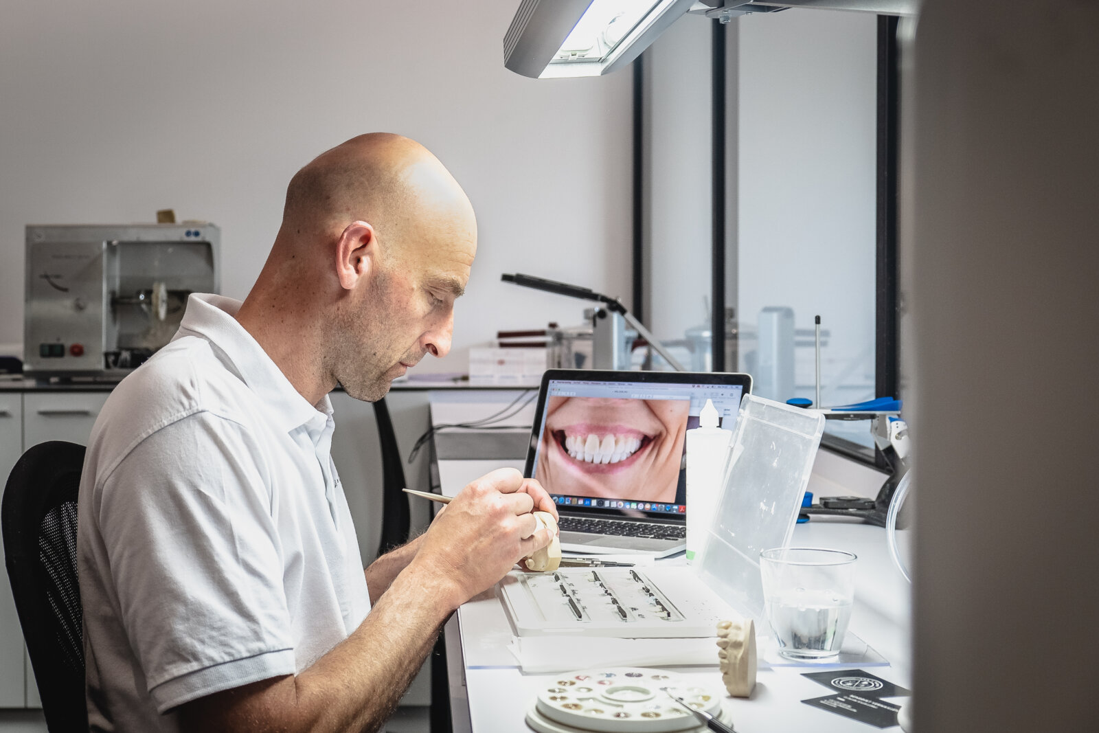 Waarom reconstructieve tandheelkunde laten uitvoeren?